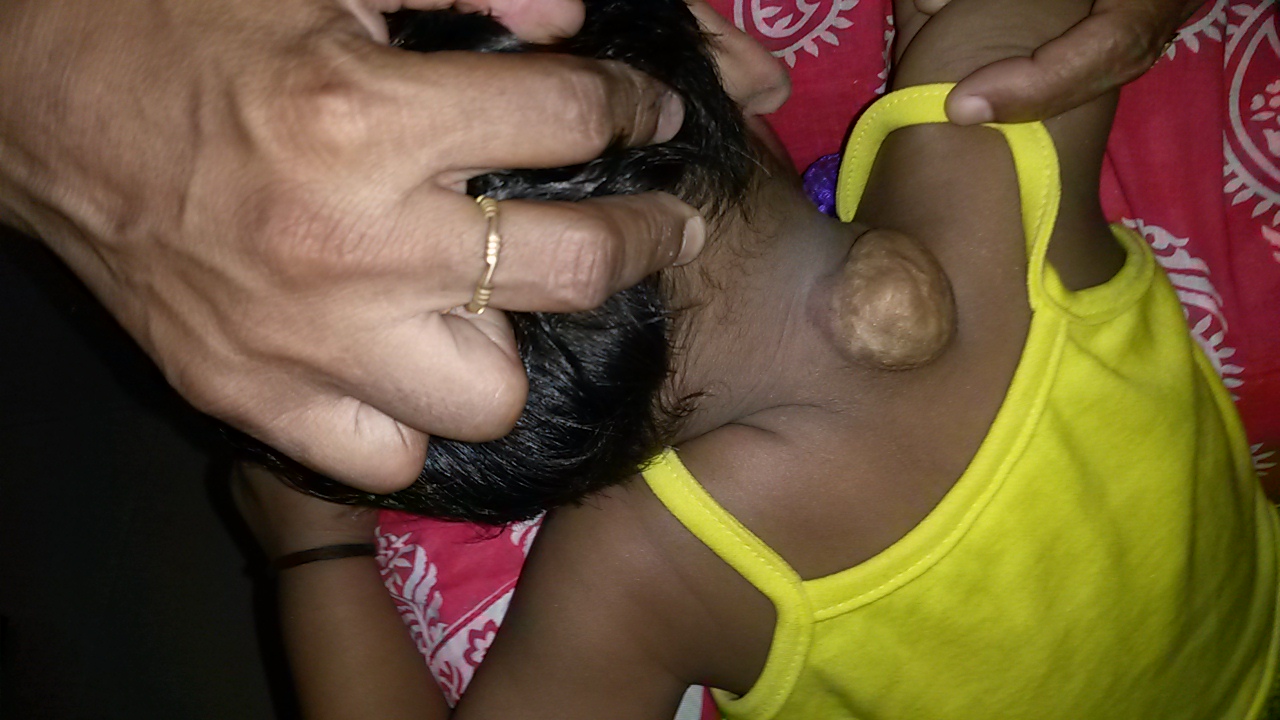 Pediatric Neurosurgery Image 2